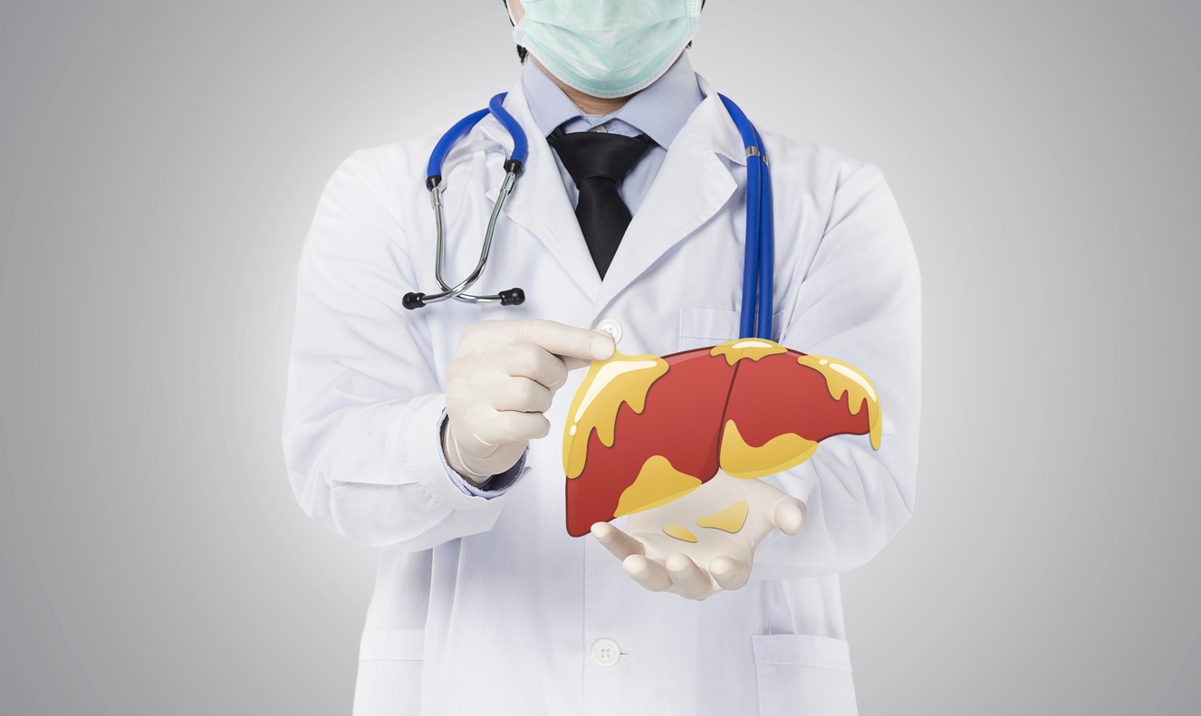 Leia mais sobre o artigo Gordura no fígado: 5 dúvidas sobre a esteatose hepática